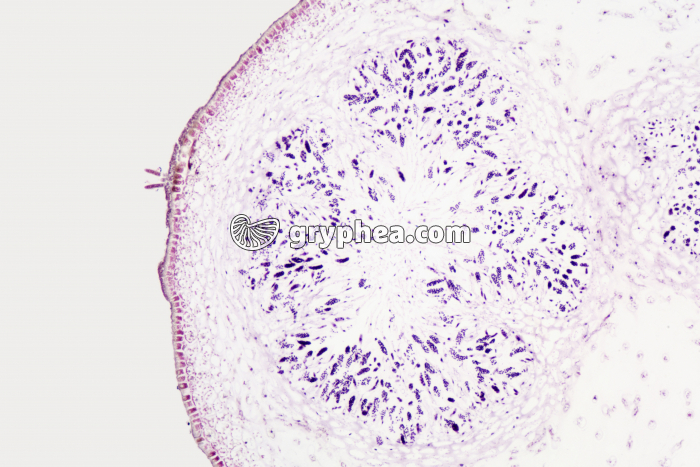 Fucus dioïque - conceptacle mâle en CL x25 - gryphea.org